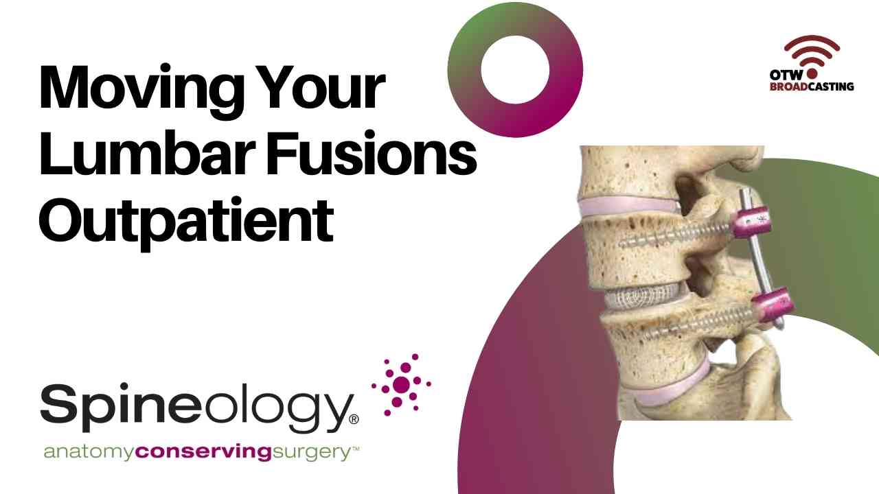 Moving Your Lumbar Fusions Outpatient
