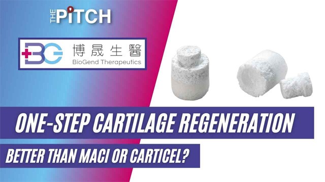 One-Step Cartilage Regeneration Better Than MACI or Carticel?