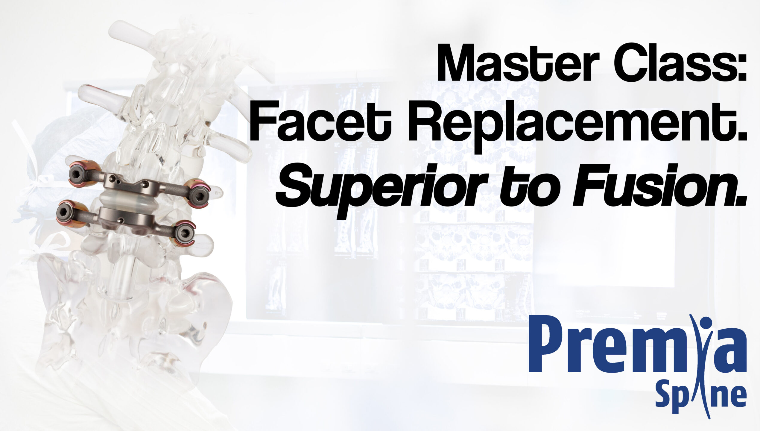 Facet Replacement: Superior to Fusion